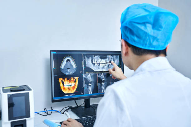 Best Broken or Cracked Tooth Emergency Dentist in Union, NJ